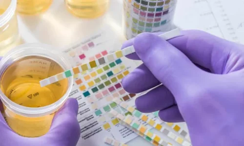 Maintaining Clean and Compliant Drivers: The Reason why Drug Testing Services by Drivers are Important.